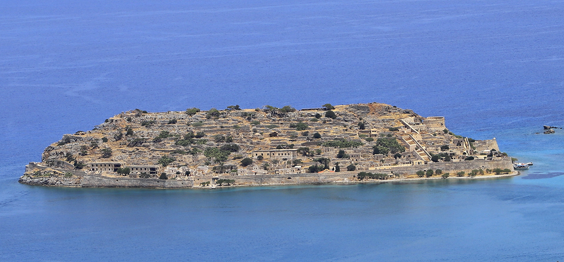 Spinalogna