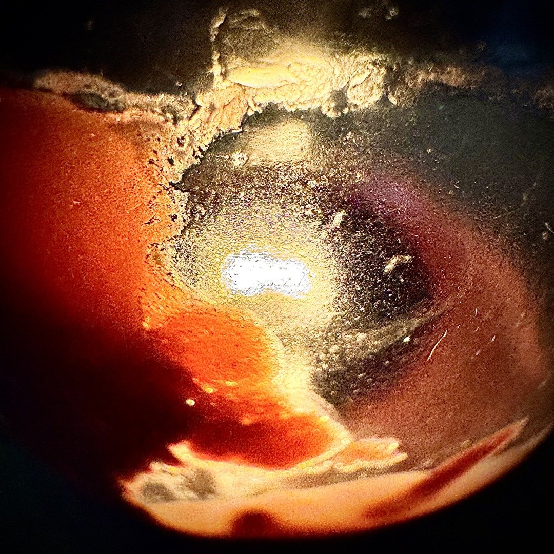 Supernova