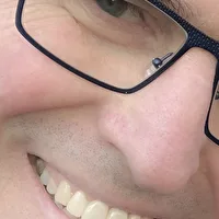 Profilfoto