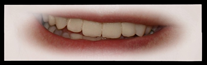 Zähne_Das Aushängeschild für ein Lächelm.